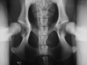 We perform penn hip radiology  . Here is a distraction view of the procedure.